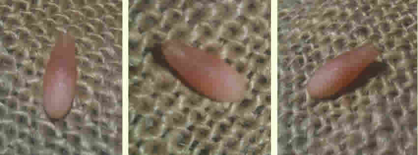 Pine Nut Seed Frostbite